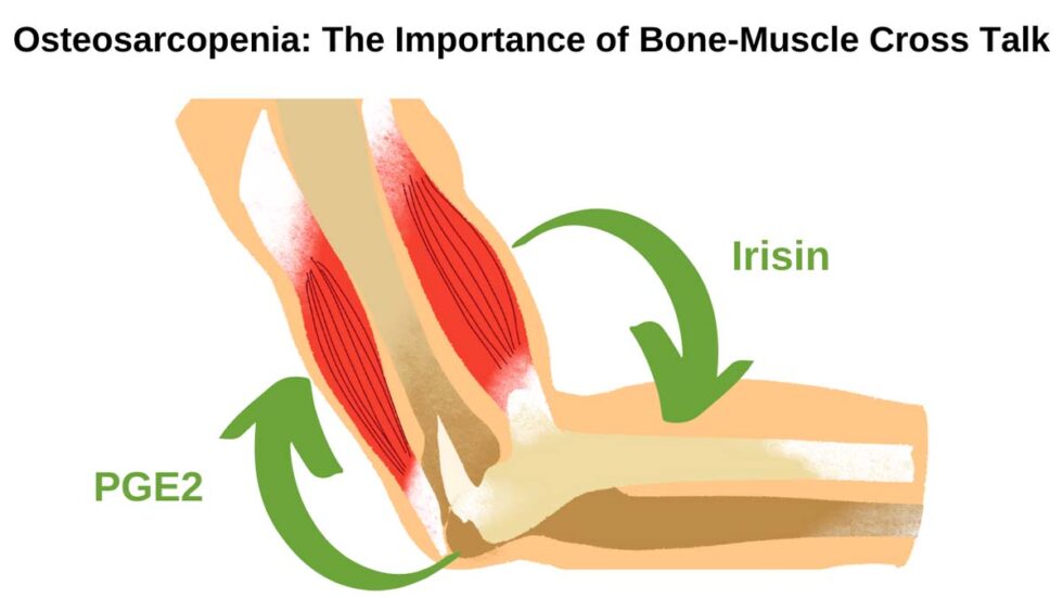 Osteosarcopenia: The Importance of Bone-Muscle Crosstalk - Nurtured Bones