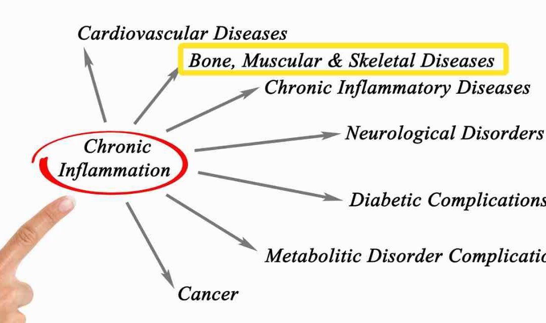 Is Inflammation Behind Your Bone Loss?